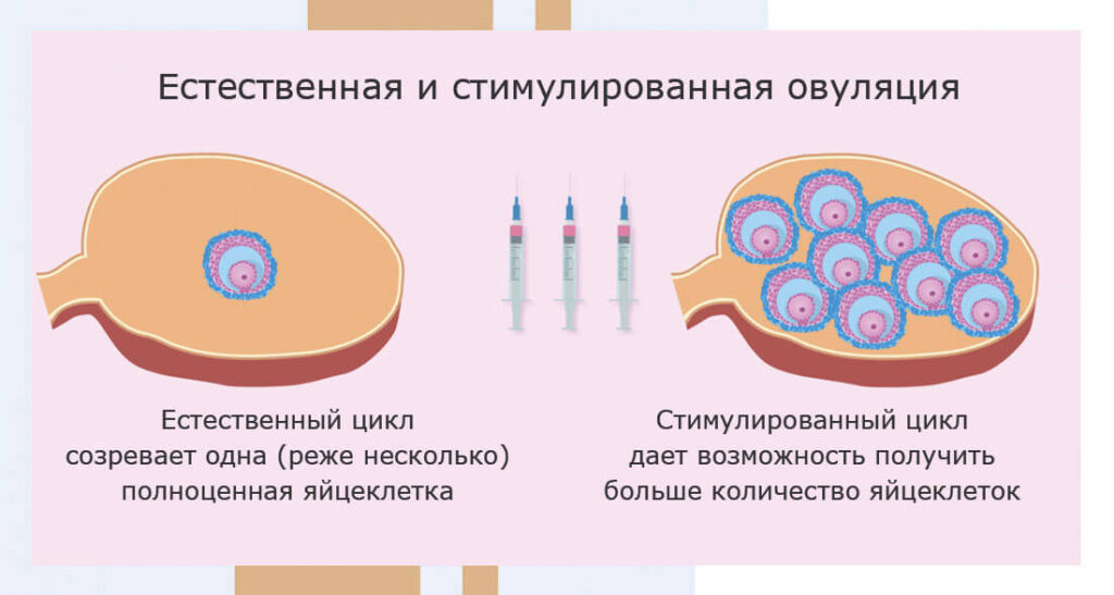 Увеличение шансов на зачатие с помощью гормональной стимуляции